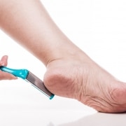 Calluses treatment