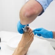 Nurse is taking care of patient after nail operation