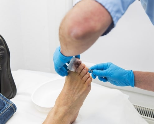 Nurse is taking care of patient after nail operation