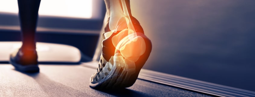 person with pain in heel