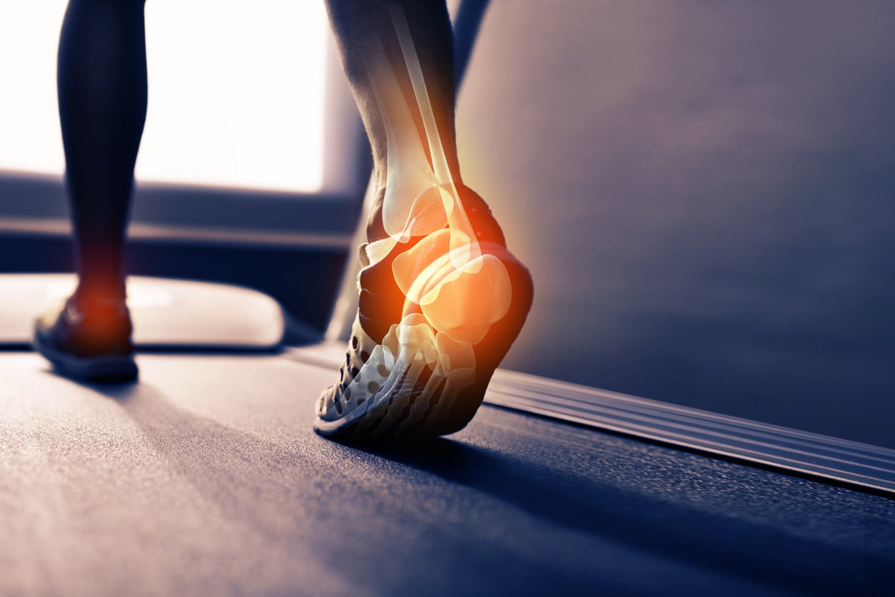 Plantar Fasciitis: Heel Pain when Running - AB Pilates