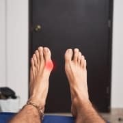 guy-with-bunions